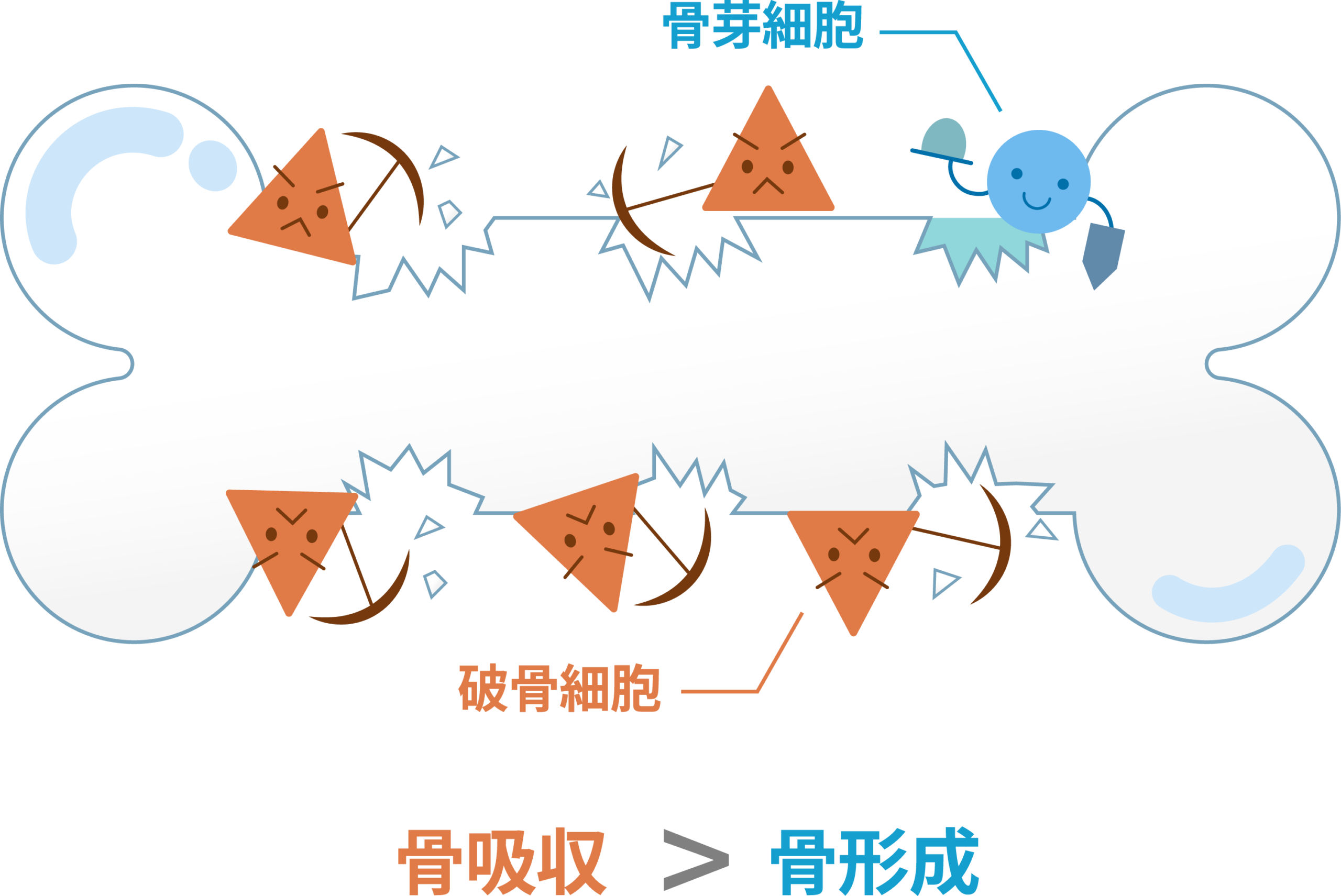osteoporosis-bone-remodeling-osteoblast-osteoclast | 芦屋市の内科・皮膚診療・小児診療 | あしやサニークリニック内科 骨芽細胞による骨形成と破骨細胞による骨吸収のバランス(骨リモデリング)を示す図。骨粗鬆症では骨吸収が骨形成を上回る。